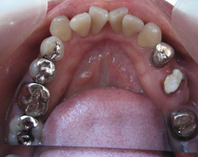 矯正歯科・インプラント専門のささき歯科クリニック‐盛岡