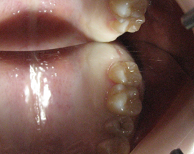 矯正歯科・インプラント専門のささき歯科クリニック‐盛岡